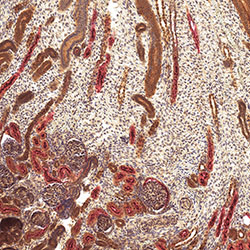 sars-cov-2 gene expression in a human fetus
